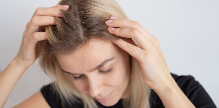 Dandruff Medical Shampoo