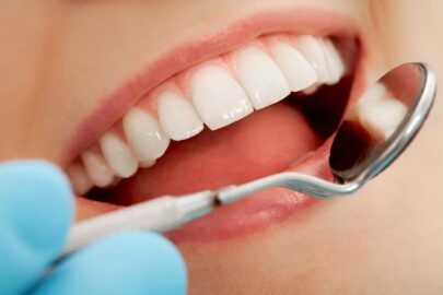 Impact of Nutrition on Oral Health