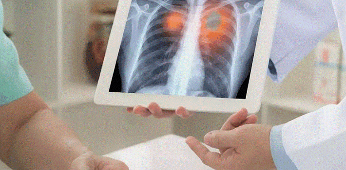 imaging quality leads