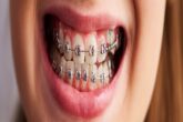 Orthodontic Procedures and Treatment