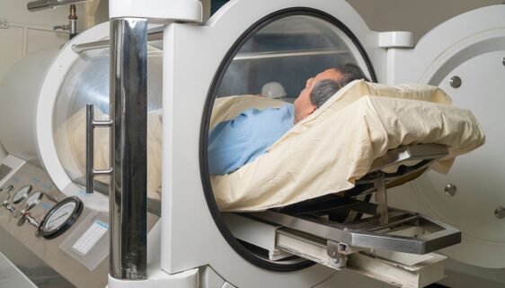 Hyperbaric Oxygen Therapy (HBOT)