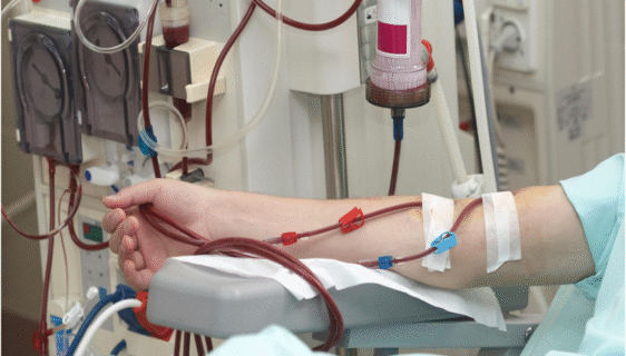 dialysis equipment supplier