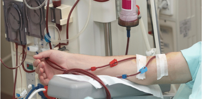 dialysis equipment supplier